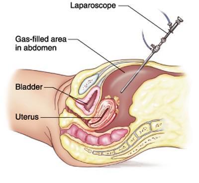 Surgical treatment